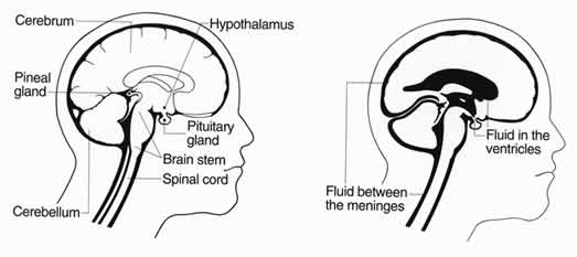 Hypophysectomy or Removal of the pituitary gland.